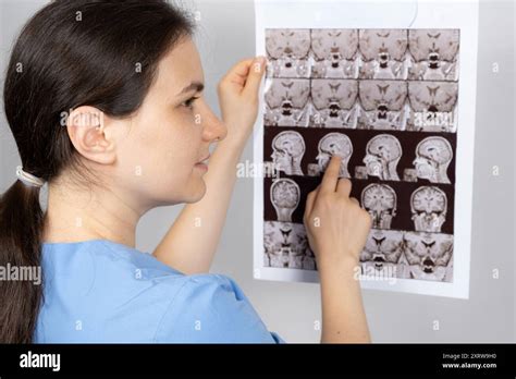 Premium Photo The Doctor Holds An Mri Image Of The Pituitary Gland Of Premium Photo The Doctor Holds An Mri Image Of The Pituitary Gland Of